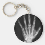 B&W de Hand van het Skelet van de röntgenstraal Sleutelhangers