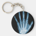 De blauwe Hand van het Skelet van de Röntgenstraal Sleutel Hangers
