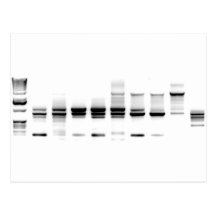 Gel d'ADN Cartes Postales