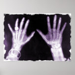 Mains de rayon X et bijoux squelettiques - pourpre Posters