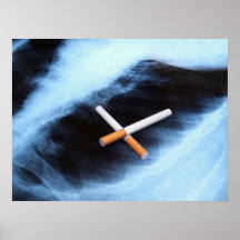 Tache de Cancer Posters