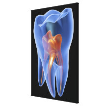 Tand, transparante dwarsdoorsnede van een kies stretched canvas print