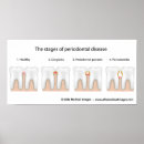 Recherche de tooth posters Dental