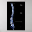 Recherche de colonne vertébrale art Médical