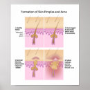 Zoek naar dermatoloog posters Arts