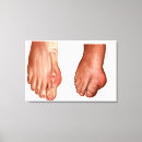 Recherche de anatomie pied art Orteil