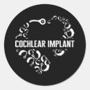Recherche de implant autocollants Cochléaire