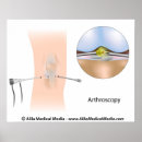 Recherche de chirurgical posters Anatomie