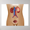 Recherche de urinaire posters Translucide