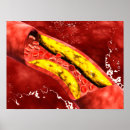 Zoek naar cytoplasma posters Cardiovasculair systeem