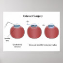 Recherche de chirurgie posters Replacement