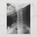 Recherche de radiologie cartes postales Radiographe