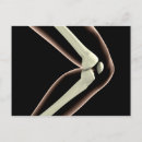 Zoek naar knie briefkaarten Menselijke ledematen