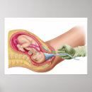 Recherche de foetus art Gestation