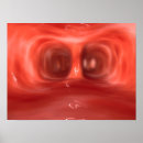 Recherche de pulmonaire posters Poumon