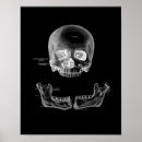 Recherche de crâne humain posters Anatomie