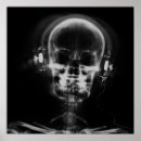 Recherche de xray posters Noir et blanc