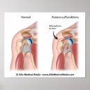 Recherche de blessure posters Chirurgie