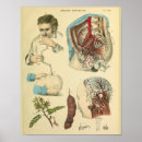 Recherche de chirurgie m art Vintage
