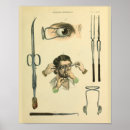 Recherche de chirurgie m art Vintage