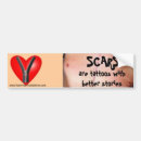 Recherche de déviation Cabg