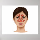 Recherche de sinus Santé