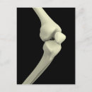 Recherche de articulé cartes postales Joint