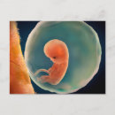 Recherche de foetus cartes postales Enceinte