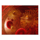 Recherche de globules sanguins posters Médecine