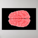 Recherche de lobe posters Neurologie