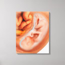 Recherche de foetus art Développement