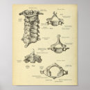 Recherche de épine Chiropractie