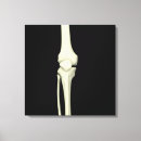 Recherche de squelette impressions sur toile Médecine
