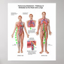 Recherche de pulmonaire posters Anatomie