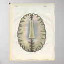 Recherche de neurologie posters Cerveau
