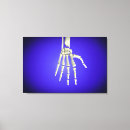 Zoek naar menselijke hand posters Distaal