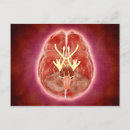 Recherche de nerf cartes postales Système nerveux périphérique