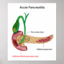 Recherche de pancréatite Anatomie