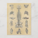 Recherche de médecine médiévale posters Médical