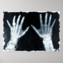 Recherche de rayons x posters Halloween