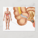 Recherche de organes humains cartes postales Cecum