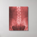 Recherche de radiographie art Médecin
