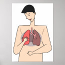 Recherche de pulmonaire posters Santé