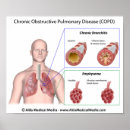 Recherche de pulmonaire posters Anatomie