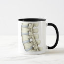Recherche de vertèbres tasses Petite entreprise