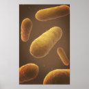 Recherche de pathologie art Grossissement