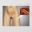 Recherche de globules rouges cartes postales Sang