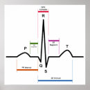 Recherche de ecg posters Coeur