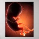 Recherche de foetus posters Médical