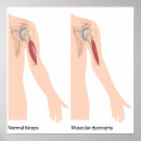 Recherche de musculaire posters Humain